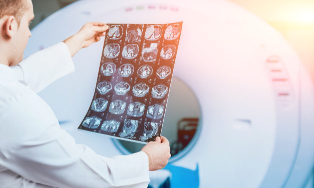 Performanță în imagistica medicală. Ce înseamnă reducerea dozelor de radiații folosite în examinările CT?